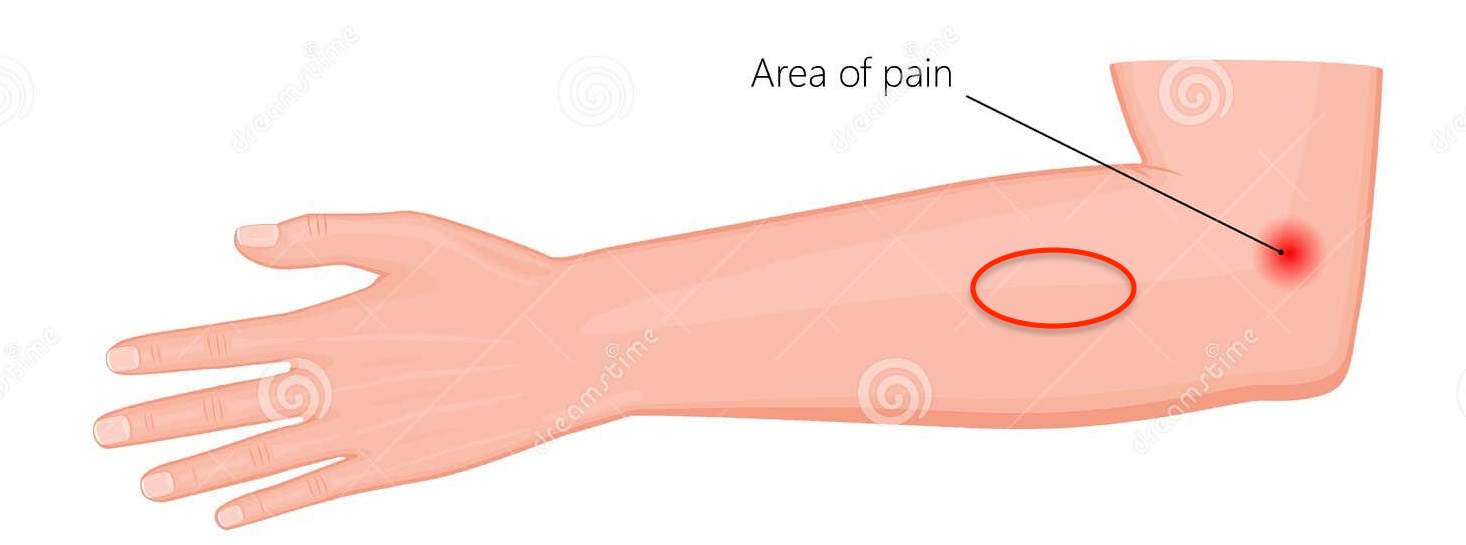 Avrostning - Några tips.